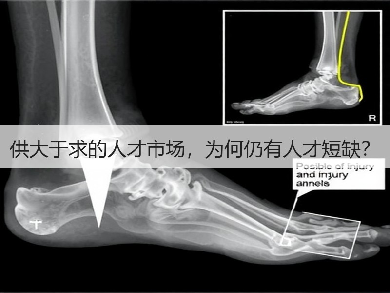 供大于求的人才市场，为何仍有人才短缺？